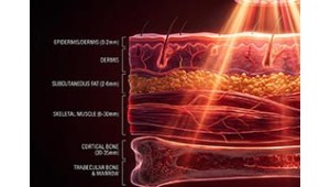 Nah-Infrarot-Therapie erklärt